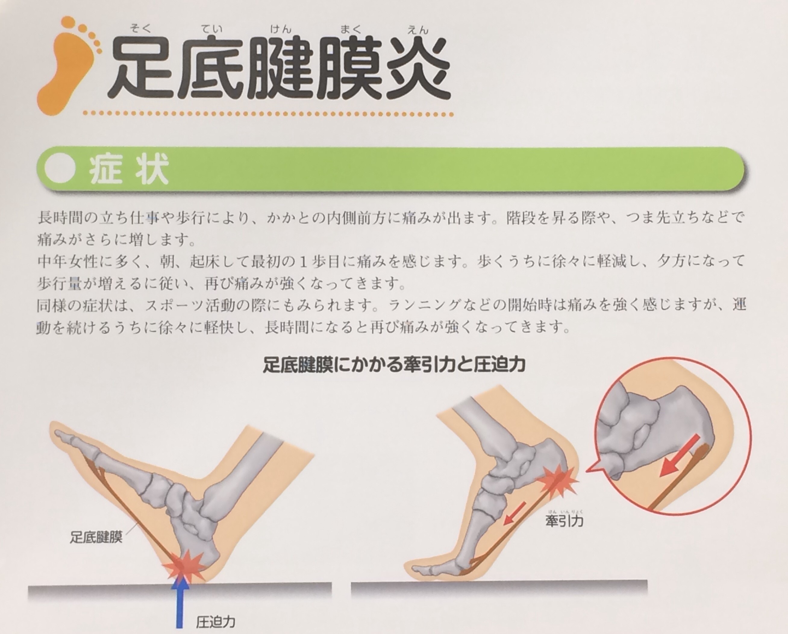 足の痛みは病気のサイン 病院でつくるインソールは やまぐち整形外科クリニック で