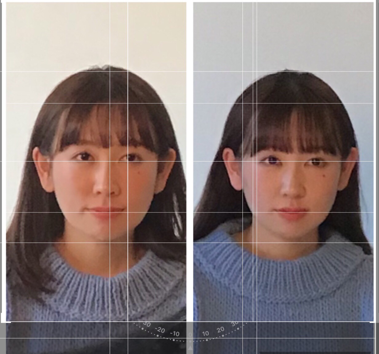 グリグリ痛い施術は無し 短時間でも変化すると話題のミラクル若顔とは ラヴィーナス グリグリ痛い施術は無し 短時間でも変化すると話題のミラクル若顔とは ラヴィーナス